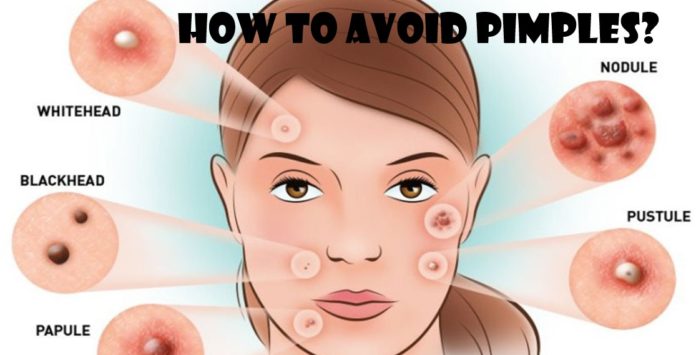 How To Avoid Pimples