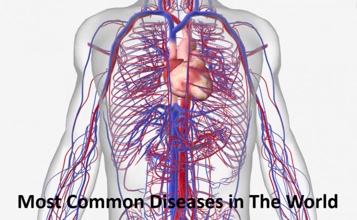 Most Common Diseases in The World